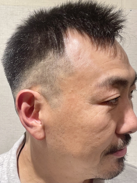 スキンフェード