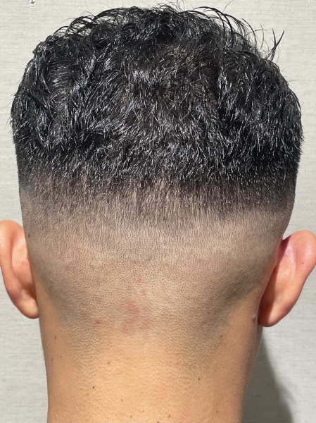 スキンフェード