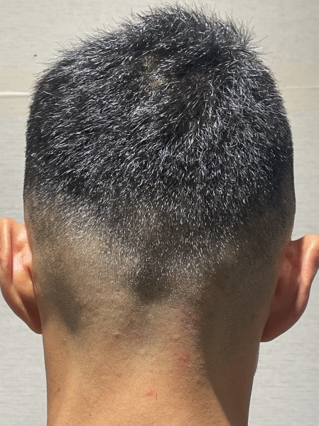 スキンフェード