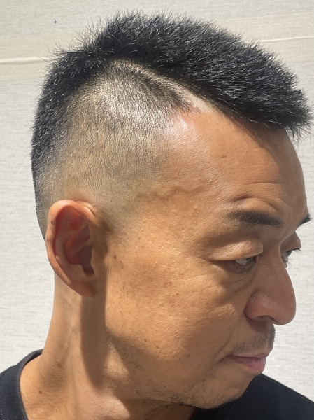 スキンフェード