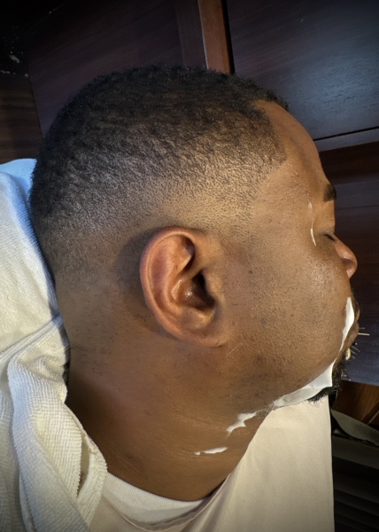 ロースキンフェード